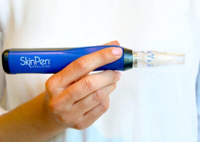 Micro-Needling SkinPen